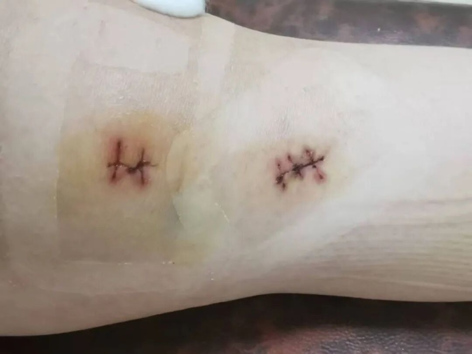 箱与我们取, 可赛后不久